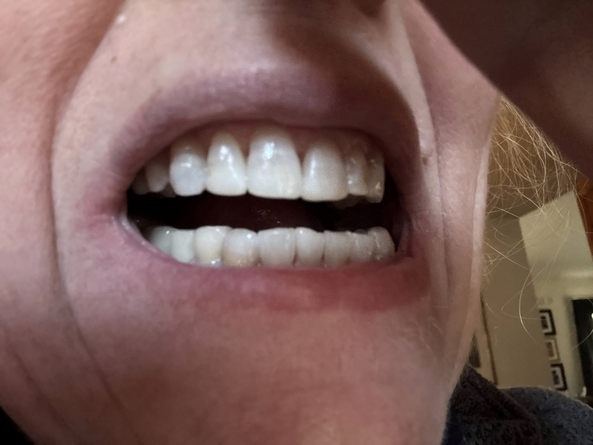 kor whitening photo #2